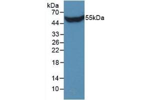 Detection of Recombinant STC1, Human using Monoclonal Antibody to Stanniocalcin 1 (STC1)