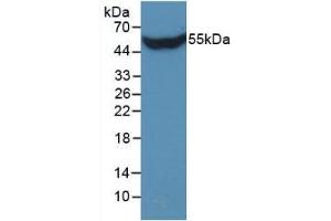 Detection of Recombinant STC1, Human using Monoclonal Antibody to Stanniocalcin 1 (STC1) (Stanniocalcin 1 anticorps  (AA 28-247))