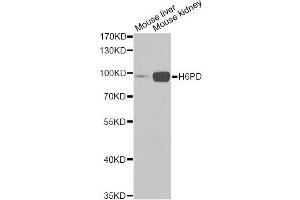 Western blot analysis of extracts of various cell lines, using H6PD Antibody. (Glucose-6-Phosphate Dehydrogenase anticorps)