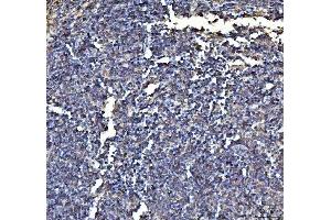 IHC analysis of Annexin VI/ANXA6 using anti-Annexin VI/ANXA6 antibody (ABIN5692982).