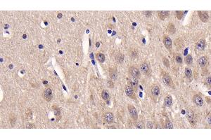 Detection of CSNK1d in Human Cerebrum Tissue using Monoclonal Antibody to Casein Kinase 1 Delta (CSNK1d) (Casein Kinase 1 delta anticorps  (AA 1-409))