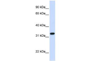 WB Suggested Anti-TBCB Antibody Titration: 0. (TBCB anticorps  (C-Term))