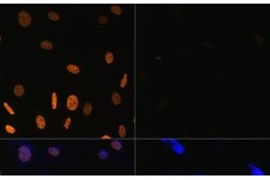 Immunofluorescence analysis of NIH/3T3 cells using Acetyl-Histone H3-K9/K14/K18/K23/K27 Polyclonal Antibody at dilution of 1:100.