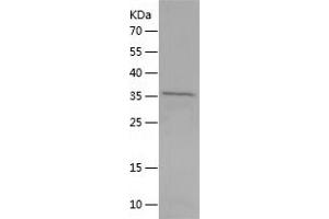 Western Blotting (WB) image for Musashi Homolog 2 (MSI2) (AA 1-328) protein (His tag) (ABIN7124029)