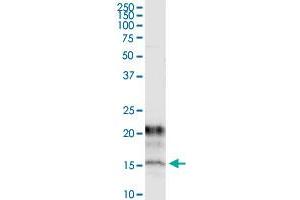 Immunoprecipitation of KCNE1 transfected lysate using anti-KCNE1 monoclonal antibody and Protein A Magnetic Bead , and immunoblotted with KCNE1 MaxPab rabbit polyclonal antibody.