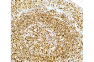Immunohistochemistry (IHC) image for anti-MHC Class II HLA-DP/DQ/DR (HLA-DP/DQ/DR) antibody (ABIN7449429) (MHC Class II HLA-DP/DQ/DR anticorps)