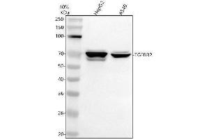 Western blot analysis of TGFBR2 using anti-TGFBR2 antibody (ABIN3043311).