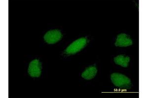 Immunofluorescence of purified MaxPab antibody to YEATS4 on HeLa cell. (GAS41 anticorps  (AA 1-227))