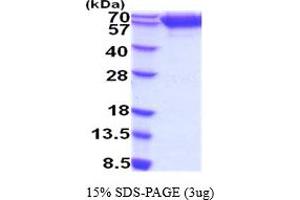 SDS-PAGE (SDS) image for Neurotrophic Tyrosine Kinase, Receptor, Type 2 (NTRK2) (AA 32-430) protein (His tag) (ABIN5854466)