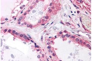 Human Thyroid: Formalin-Fixed, Paraffin-Embedded (FFPE)