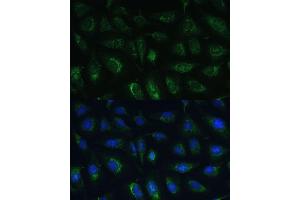 Immunofluorescence analysis of U-2 OS cells using R Polyclonal Antibody (ABIN7269849) at dilution of 1:100 (40x lens). (GRF2 anticorps  (AA 844-1095))