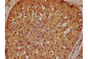 anti-SH3-Binding Domain Kinase Family, Member 2 (SBK2) (AA 62-330) antibody