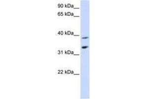 SLC25A34 anticorps  (C-Term)