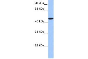 WB Suggested Anti-REXO4 Antibody Titration:  0.