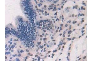 Detection of DRD1 in Human Uterus Tissue using Polyclonal Antibody to Dopamine Receptor D1 (DRD1)