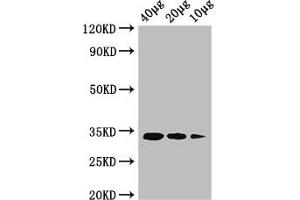 Western Blot Positive WB detected in: Rosseta bacteria lysate at 40 μg, 20 μg, 10 μg All lanes: ldcA antibody at 1 μg/mL Secondary Goat polyclonal to rabbit IgG at 1/50000 dilution predicted band size: 34 kDa observed band size: 34 kDa (LDCA (AA 1-304) anticorps (Biotin))