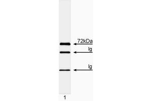 Immunoprecipitation/western blot analysis of Itk.