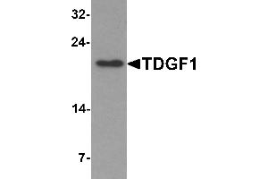 Western Blotting (WB) image for anti-Teratocarcinoma-Derived Growth Factor 1 (TDGF1) (N-Term) antibody (ABIN1077401) (TDGF1 anticorps  (N-Term))