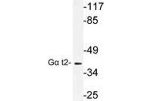 Western blot (WB) analysis of Gα t2 antibody in extracts from COLO cells. (GNAT2 anticorps)