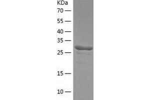 Western Blotting (WB) image for Phenazine Biosynthesis-Like Protein Domain Containing 1 (PBLD1) (AA 1-288) protein (His tag) (ABIN7124389) (PBLD1 Protein (AA 1-288) (His tag))