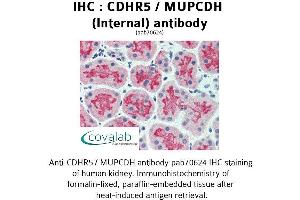 Image no. 2 for anti-Mucin and Cadherin-Like (CDHR5) (Internal Region) antibody (ABIN1732924) (CDHR5 anticorps  (Internal Region))