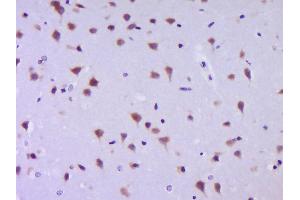 Paraformaldehyde-fixed, paraffin embedded Mouse brain Antigen retrieval by boiling in sodium citrate buffer (pH6.