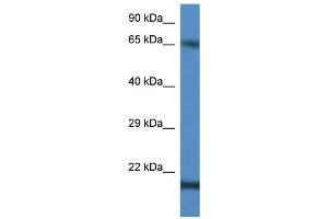anti-Cancer/testis Antigen 1B (CTAG1B) (C-Term) antibody
