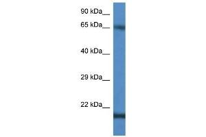 Western Blot showing CTAG1B antibody used at a concentration of 1 ug/ml against Jurkat Cell Lysate (CTAG1B anticorps  (C-Term))
