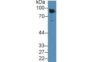 Detection of Plg in Rat Serum using Polyclonal Antibody to Plasminogen (Plg) (PLG anticorps  (AA 191-433))
