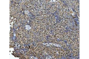 IHC analysis of HSF1 using anti-HSF1 antibody (ABIN7602894).