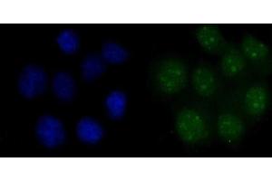 IF analysis of FEN1 using anti-FEN1 antibody (ABIN7601619). (FEN1 anticorps  (AA 4-300))