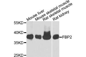 Western blot analysis of extracts of various cells, using FBP2 antibody. (FBP2 anticorps)