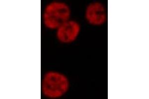 ABIN6268985 staining HeLa cells by IF/ICC. (HNRNPD/AUF1 anticorps  (pSer83))