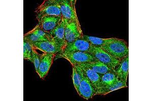 Immunocytochemistry (ICC) image for anti-Protein-tyrosine Phosphatase 1C (PTPN6) (AA 243-541) antibody (ABIN5874772) (SHP1 anticorps  (AA 243-541))
