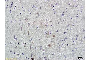 Formalin-fixed and paraffin embedded rat brain labeled with Anti-Phospho-CaMKII (Thr286) Polyclonal Antibody, Unconjugated (ABIN732473) at 1:200 followed by conjugation to the secondary antibody and DAB staining.
