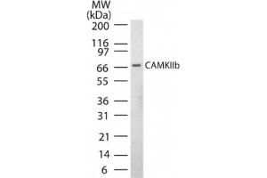 Image no. 1 for anti-Calcium/calmodulin-Dependent Protein Kinase II beta (CAMK2B) (AA 499-513) antibody (ABIN221188) (CAMK2B anticorps  (AA 499-513))
