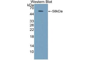 Western blot analysis of the recombinant protein. (FOS anticorps  (AA 6-240))