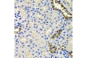 Immunohistochemistry of paraffin-embedded mouse kidney using CALB2 antibody. (Calretinin anticorps  (AA 1-271))