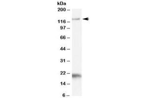 Western blot testing of Daudi cell lysate with HTATSF1 antibody at 1ug/ml. (HTATSF1 anticorps)