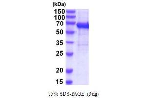SDS-PAGE (SDS) image for Interleukin 12 Receptor beta 1 (IL12RB1) (AA 24-545) protein (His tag) (ABIN5854228) (IL12RB1 Protein (AA 24-545) (His tag))