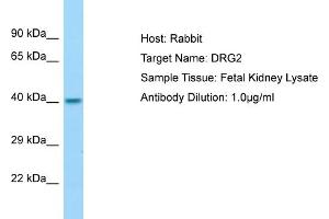 Host: Rabbit Target Name: DRG2 Sample Type: Fetal Kidney lysates Antibody Dilution: 1.