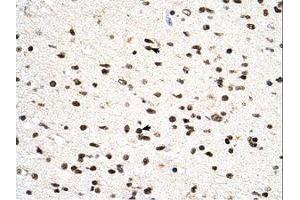 Image no. 1 for anti-Phosphatidylglycerophosphate Synthase 1 (PGS1) (C-Term) antibody (ABIN6738518)