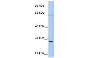 HPRT1 antibody used at 1 ug/ml to detect target protein. (HPRT1 anticorps)