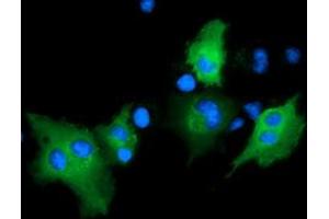 Image no. 5 for anti-rho GTPase Activating Protein 25 (ARHGAP25) antibody (ABIN1496701) (ARHGAP25 anticorps)