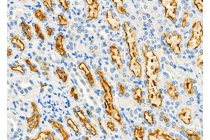 ABIN6263739 and ABIN6277291 at 1/100 staining Rat kidney tissue by IHC-P.