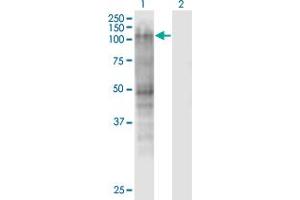 Western Blot analysis of MSH2 expression in transfected 293T cell line by MSH2 monoclonal antibody (M01), clone 2G9. (MSH2 anticorps  (AA 835-934))
