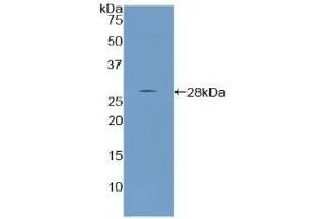 Detection of Recombinant PTHrP, Human using Polyclonal Antibody to Parathyroid Hormone Related Protein (PTHrP) (PTHLH anticorps  (AA 37-177))