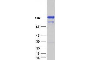 Validation with Western Blot