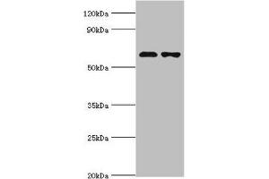 Western blot All lanes: Sterol O-acyltransferase 1 antibody at 2 μg/mL Lane 1: 293T whole cell lysate Lane 2: Jurkat whole cell lysate Secondary Goat polyclonal to rabbit IgG at 1/10000 dilution Predicted band size: 65, 59, 58 kDa Observed band size: 65 kDa (SOAT1 anticorps  (AA 1-130))