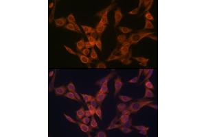 Immunofluorescence analysis of NIH-3T3 cells using ULK3 Rabbit mAb (ABIN7271222) at dilution of 1:100 (40x lens). (ULK3 anticorps)
